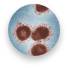 glioblastoma
